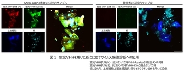 花王、繊維に付着した新型コロナウイルスを可視化できる可能性を共同発見　VHH抗体と高輝度蛍光タンパク質を連結