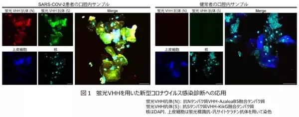 花王、繊維に付着した新型コロナウイルスを可視化できる可能性を共同発見　VHH抗体と高輝度蛍光タンパク質を連結