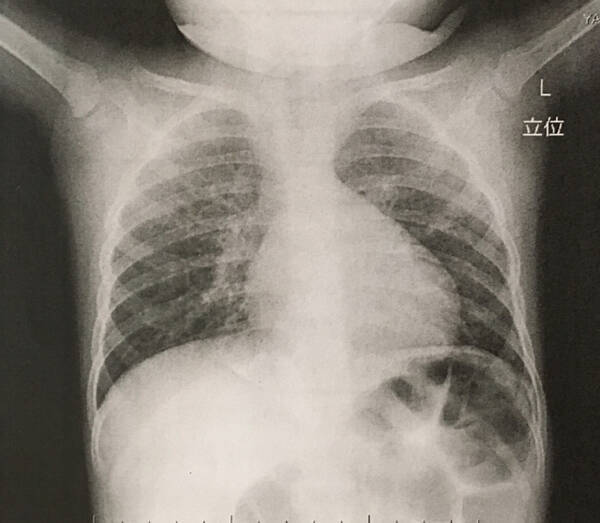 肺を鍛えるとすべてが変わる コロナ禍で重要な肺と免疫力の関係性を医師が解説 21年5月31日 エキサイトニュース