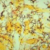 「梅毒の感染者数過去最多　全国的に増加しているその「背景」に辛坊治郎が警鐘」の画像5