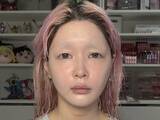 「人気YouTuber、『治らない病気』を発症。「サムネ見た時泣きそうなった」「そんな怖い病気あるんですね、、」」の画像1