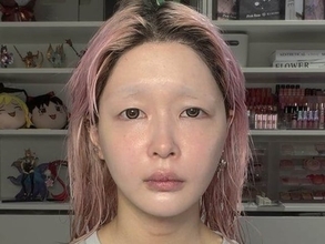 人気YouTuber、『治らない病気』を発症。「サムネ見た時泣きそうなった」「そんな怖い病気あるんですね、、」