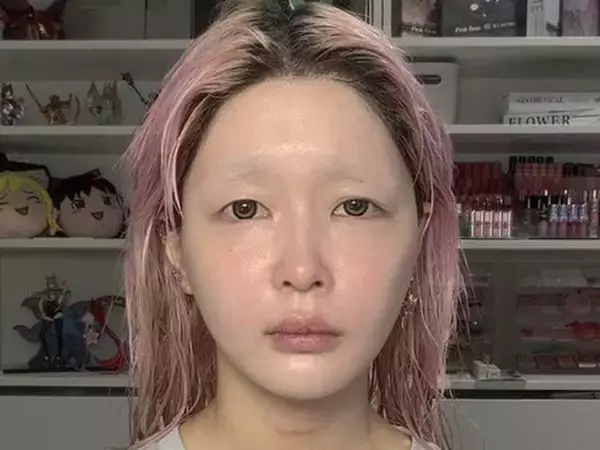 人気YouTuber、『治らない病気』を発症。「サムネ見た時泣きそうなった」「そんな怖い病気あるんですね、、」