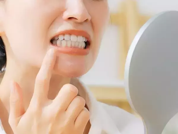 よくある口内炎、実は「がん」のサインかも……【医師が解説】
