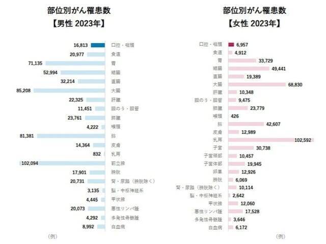 よくある口内炎、実は「がん」のサインかも……【医師が解説】