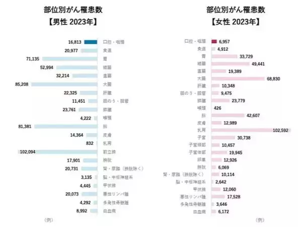 「よくある口内炎、実は「がん」のサインかも……【医師が解説】」の画像