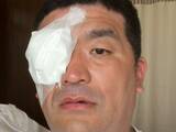 「「痛々しいです」人気芸人、手術成功を報告。「大変でしたね」「白内障になっちゃうんだ、怖…」」の画像1