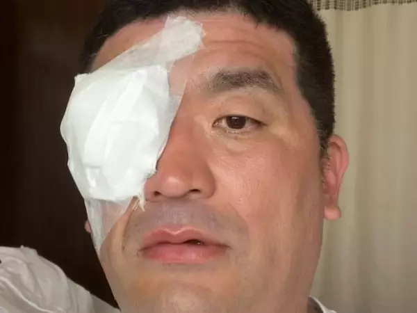 「痛々しいです」人気芸人、手術成功を報告。「大変でしたね」「白内障になっちゃうんだ、怖…」