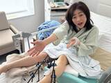「「えー何してんの！」松本明子、骨折を報告。約1カ月入院へ「大変なこと」「大丈夫ですか？痛々しいですね」」の画像1