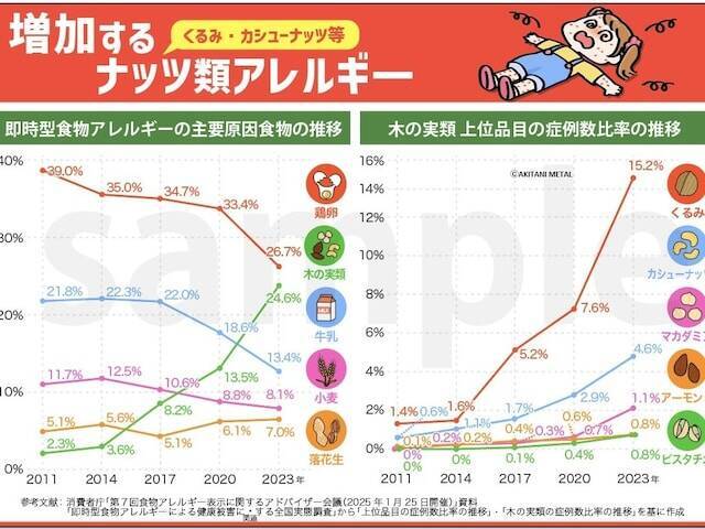 命に関わる危険性も……急増する「ナッツアレルギー」のリスク・特に注意すべきクルミとカシューナッツ