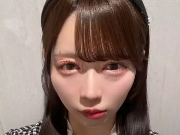 「助けて何もできない」女性アイドル、夜になると“目も唇も腫れ上がって”パンパンに。心配の声続出