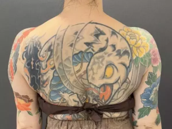 「倫理観よ、、、」美容外科医、タトゥーまみれの症例写真に「モニターする人間違ってないか？」の声