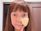 「「心配ですね」太田光代、痛々しい姿に心配の声。「殴られたと思った」「痛みは大丈夫ですか？」」の画像1