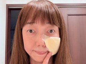 「心配ですね」太田光代、痛々しい姿に心配の声。「殴られたと思った」「痛みは大丈夫ですか？」
