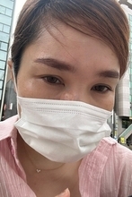 平野ノラ、顔のできものを除去したことを報告「神業で20秒くらい」