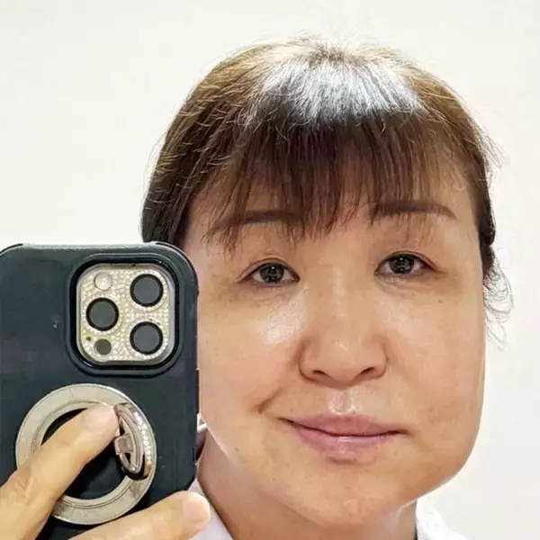 北斗晶「こぶとり爺さんみたい」歯の治療で腫れた顔を公開「笑えました」