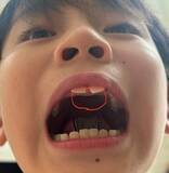 「ココリコ遠藤の妻、次男の過剰歯手術が決定し心境を吐露「手術が怖いんだなって気持ちわかるし」」の画像1