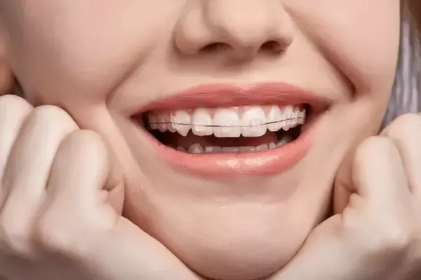 「「キレイ度」は歯並びで変わる！アラサー女性が【裏側歯料矯正】を選ぶワケ」の画像