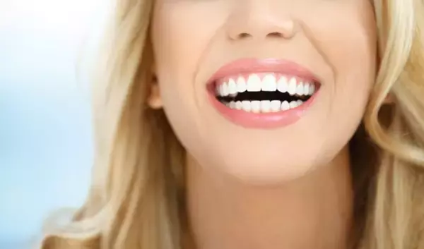 「「キレイ度」は歯並びで変わる！アラサー女性が【裏側歯料矯正】を選ぶワケ」の画像