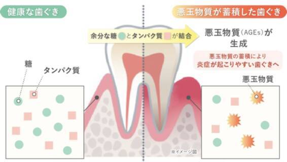 見た目年齢は「歯ぐき」で決まる？美肌の敵「糖化」は口の中でも起こっていた！