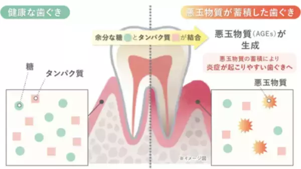 「見た目年齢は「歯ぐき」で決まる？美肌の敵「糖化」は口の中でも起こっていた！」の画像