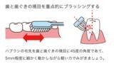 「見た目年齢は「歯ぐき」で決まる？美肌の敵「糖化」は口の中でも起こっていた！」の画像5