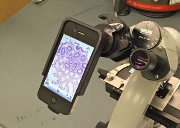 顕微鏡や一眼レフとも接続が可能 脅威のiphone追加パーツたちを紹介 12年4月26日 エキサイトニュース