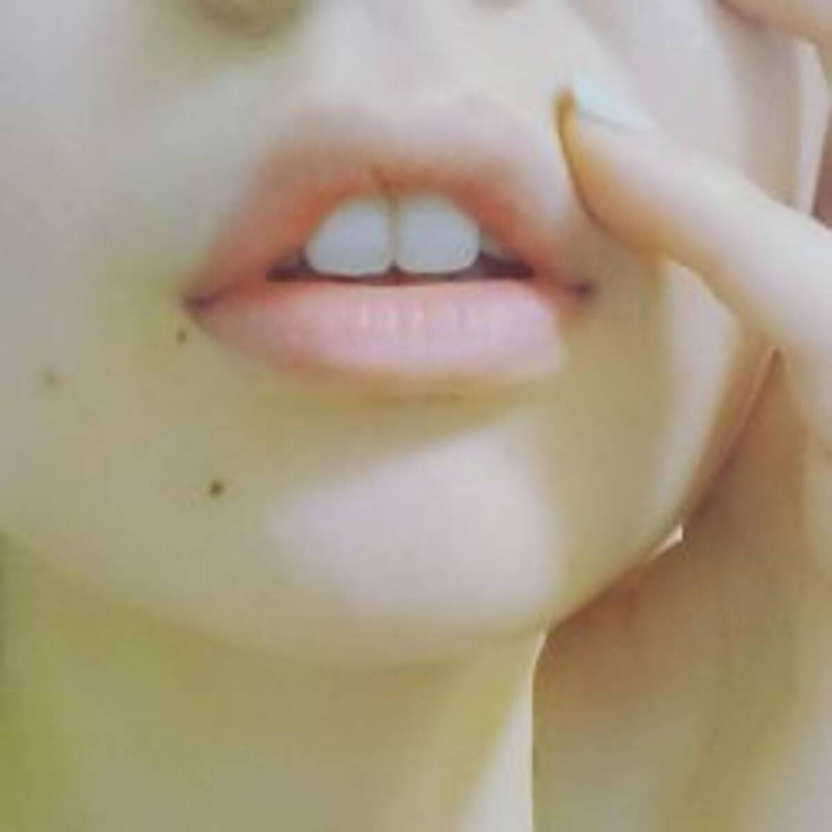 秋津壽男 どっち の健康学 加齢とともに起こる体の変化とその影響 湿しん と ほくろ はどっちが危険 18年8月6日 エキサイトニュース