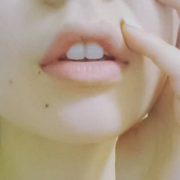 医者のはなしがよくわかる 診察室のツボ ほくろ 先天性 後天性 の差と悪性ガンの見極め方 年3月30日 エキサイトニュース