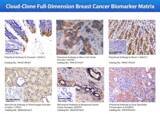 「Cloud-Clone、技術革新を推進し、乳がん精密研究の将来的な発展の道筋を描く」の画像1