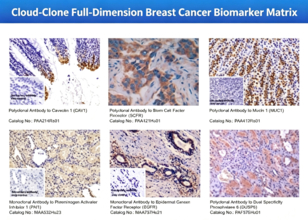 Cloud-Clone、技術革新を推進し、乳がん精密研究の将来的な発展の道筋を描く