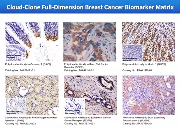 Cloud-Clone、技術革新を推進し、乳がん精密研究の将来的な発展の道筋を描く