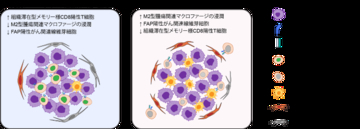 世界初の細胞環境解析により肺がん免疫療法の耐性因子を解明　耐性因子を標的とする難治性肺がんの新たな治療法開発に期待