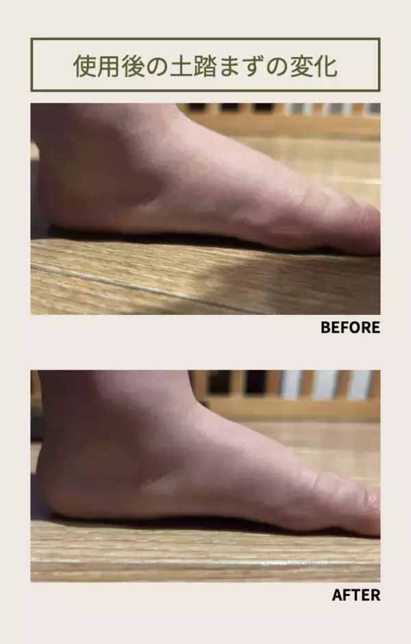 「「幼児におけるファーストシューズ着用時の足底圧分布の変化」学会発表された特殊形状ソールを採用した幼児用シューズ1pome(いっぽめ)を2026年3月3日より予約先行販売開始」の画像