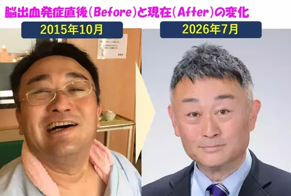 「【2026年9月1日開業】突然の脳出血から障害当事者へ。5度の挑戦で社労士試験を突破した元ビジネスマンが、障害年金特化の「名古屋明治社労士事務所」を設立」の画像