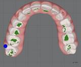 「顔の左右差の原因は“加齢”だけではない？」の画像1