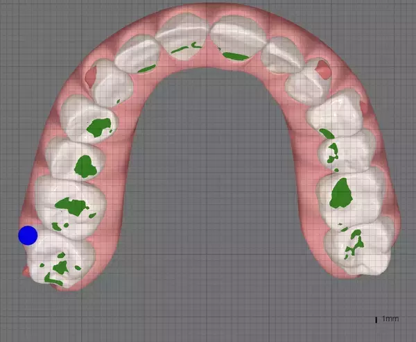 顔の左右差の原因は“加齢”だけではない？