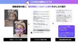 「【エルグラム活用成果公表】1投稿でフォロワー1.7万人増を達成」の画像3