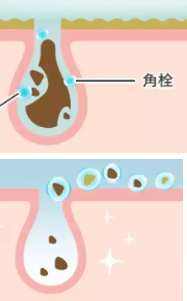 「毎日のクレンジングで毛穴角栓落として、繰り返さない　パーフェクトワンフォーカス　スムースクレンジングバーム　バージョンアップしてリニューアル！2026年3月1日先行発売(本発売4月1日)」の画像