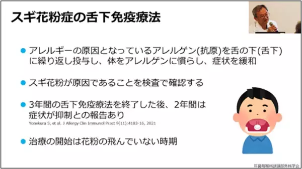 「花粉症治療の選択肢「舌下免疫療法」を解説した公開医学講座動画を公開」の画像