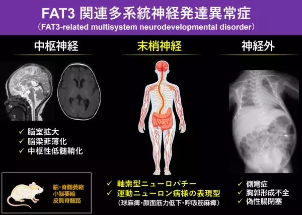 FAT3遺伝子の変異による新たな神経疾患を発見　― 進行性の末梢神経障害と全身症状を伴う「FAT3関連多系統神経発達異常症」を提唱 ―