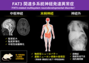 FAT3遺伝子の変異による新たな神経疾患を発見　― 進行性の末梢神経障害と全身症状を伴う「FAT3関連多系統神経発達異常症」を提唱 ―
