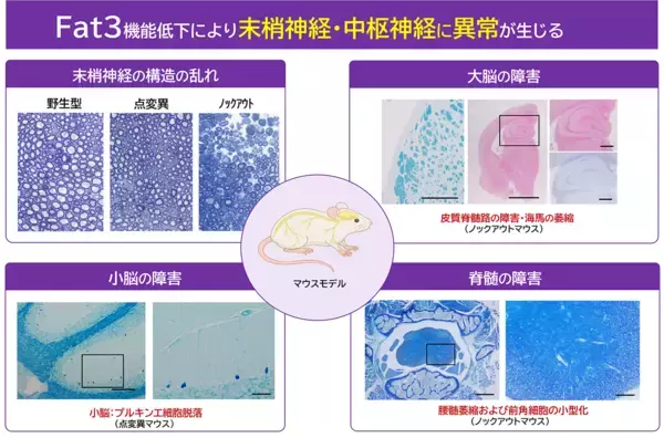 「FAT3遺伝子の変異による新たな神経疾患を発見　― 進行性の末梢神経障害と全身症状を伴う「FAT3関連多系統神経発達異常症」を提唱 ―」の画像