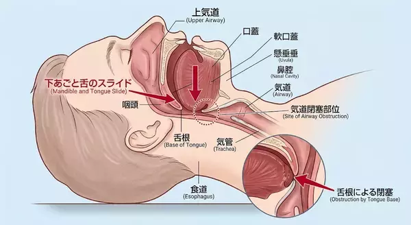 「眠りづらさの正体──世界で初めて、寝姿勢が呼吸を弱くする"構造的理由"を体系的に解析した研究　シリーズ第14回（呼吸構造の圧迫と呼吸弱化の因果線）」の画像