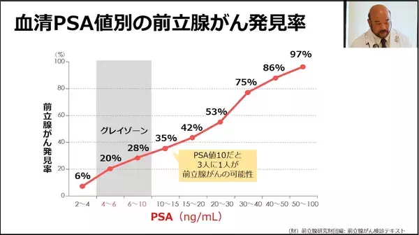 「前立腺がんの早期発見と治療を学ぶ動画公開」の画像