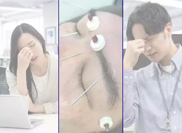 「『なくならないで』の声をきっかけに。業界初、国家資格者による専門ヘッドケア×ヘアセットの健康経営支援サービス」の画像