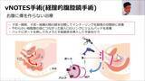 「子宮筋腫・過多月経などに対する婦人科手術講座と動画公開」の画像2