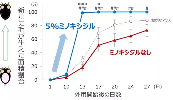 「【新知見】心身へのストレスによる抜け毛の増加（休止期脱毛症）に発毛成分「ミノキシジル」が有用な可能性を見出す」の画像