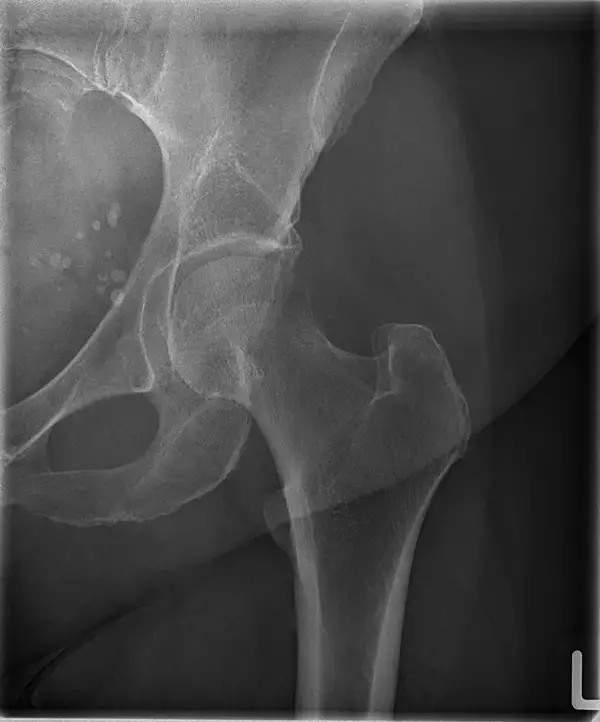 「世界で初めて宇宙でのX線撮影に成功した実機を、限定公開　ミカサエックスレイ、「国際医用画像総合展(ITEM 2026)」に出展」の画像