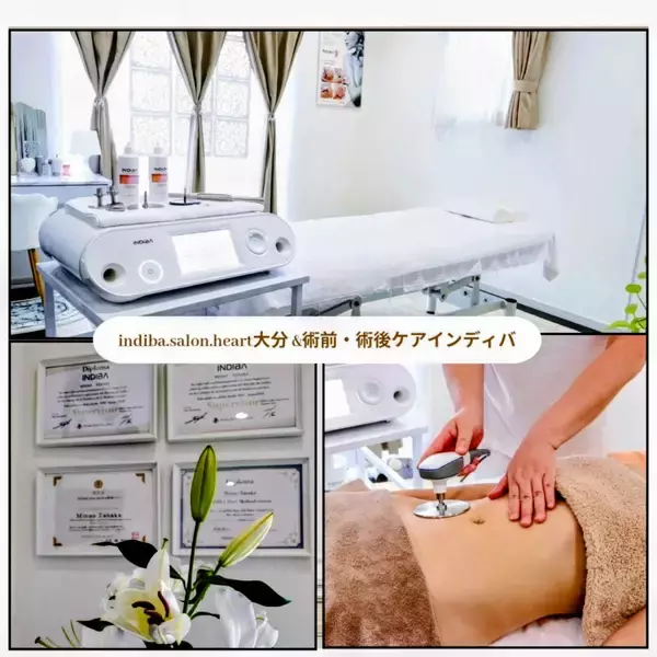 美容医療後の「回復期ケア」が注目。大分のINDIBA専門サロンが術後の身体ケア新メニューを開始